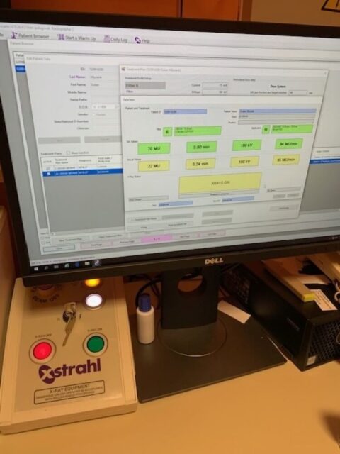 Klinika radiačnej a klinickej onkológie má nové vybavenie