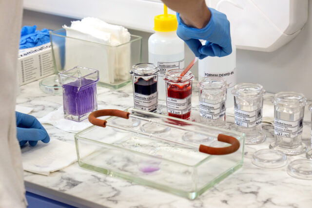 Vojenská nemocnica má novinky, výrazne zlepší svoje služby